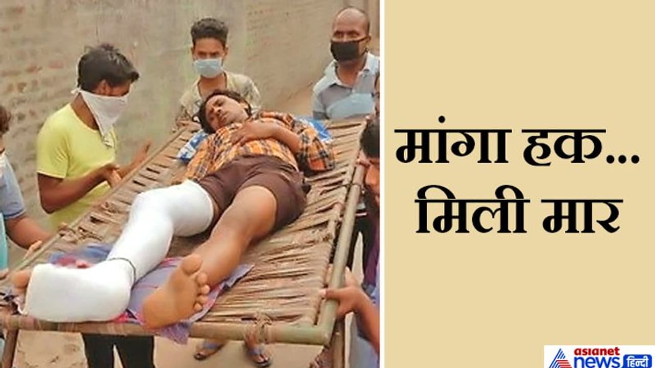 अपना हक मांगने फैक्ट्री गए थे मजदूर, बदले में मिलीं पुलिस की लाठियां, इस तरह हाथ पैर तुड़वाकर लौटे अपना हक मांगने फैक्ट्री गए थे मजदूर, बदले में मिलीं पुलिस की लाठियां, इस तरह हाथ पैर तुड़वाकर लौटे