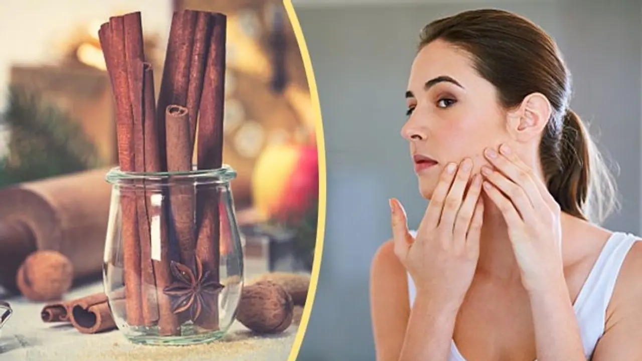 একটুকরো দারুচিনিতে বদলে যাবে ত্বকের সৌন্দর্য, জানুন কীভাবে একটুকরো দারুচিনিতে বদলে যাবে ত্বকের সৌন্দর্য, জানুন কীভাবে