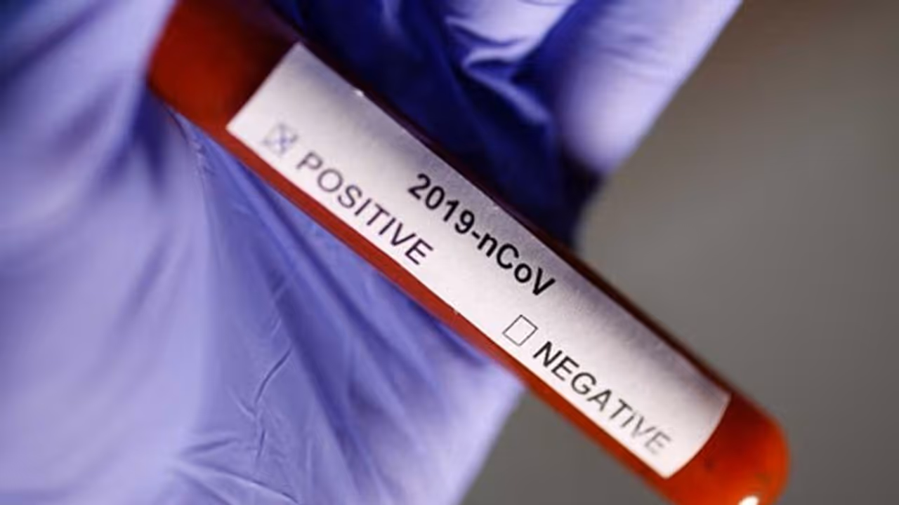 ఏపీలో తగ్గని కరోనా విజృంభణ: కేసుల సంఖ్య 2339, మొత్తం మరణాలు 52 ఏపీలో తగ్గని కరోనా విజృంభణ: కేసుల సంఖ్య 2339, మొత్తం మరణాలు 52