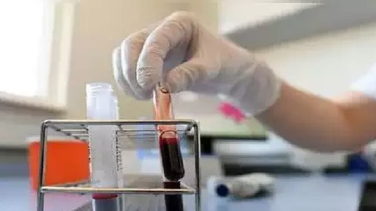 3 వేలు క్రాస్ చేసిన తెలంగాణ: కొత్తగా 129 మందికి పాజిటివ్, హైదరాబాద్లో 108 కేసులు 3 వేలు క్రాస్ చేసిన తెలంగాణ: కొత్తగా 129 మందికి పాజిటివ్, హైదరాబాద్లో 108 కేసులు