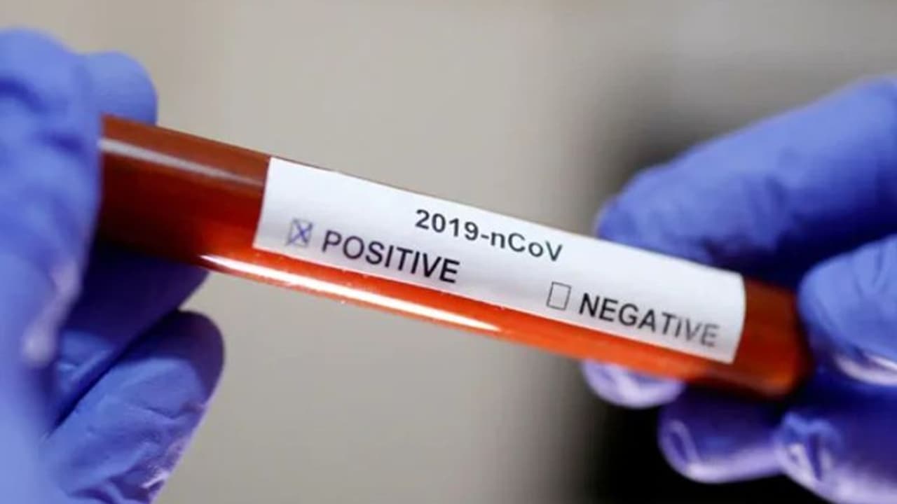 '30 സെക്കന്‍റില്‍ കൊറോണയെ കണ്ടെത്താം' ; ഇന്ത്യയും ഇസ്രയേലും വികസിപ്പിച്ച ടെസ്റ്റിംഗ് രീതി പരീക്ഷണത്തില്‍