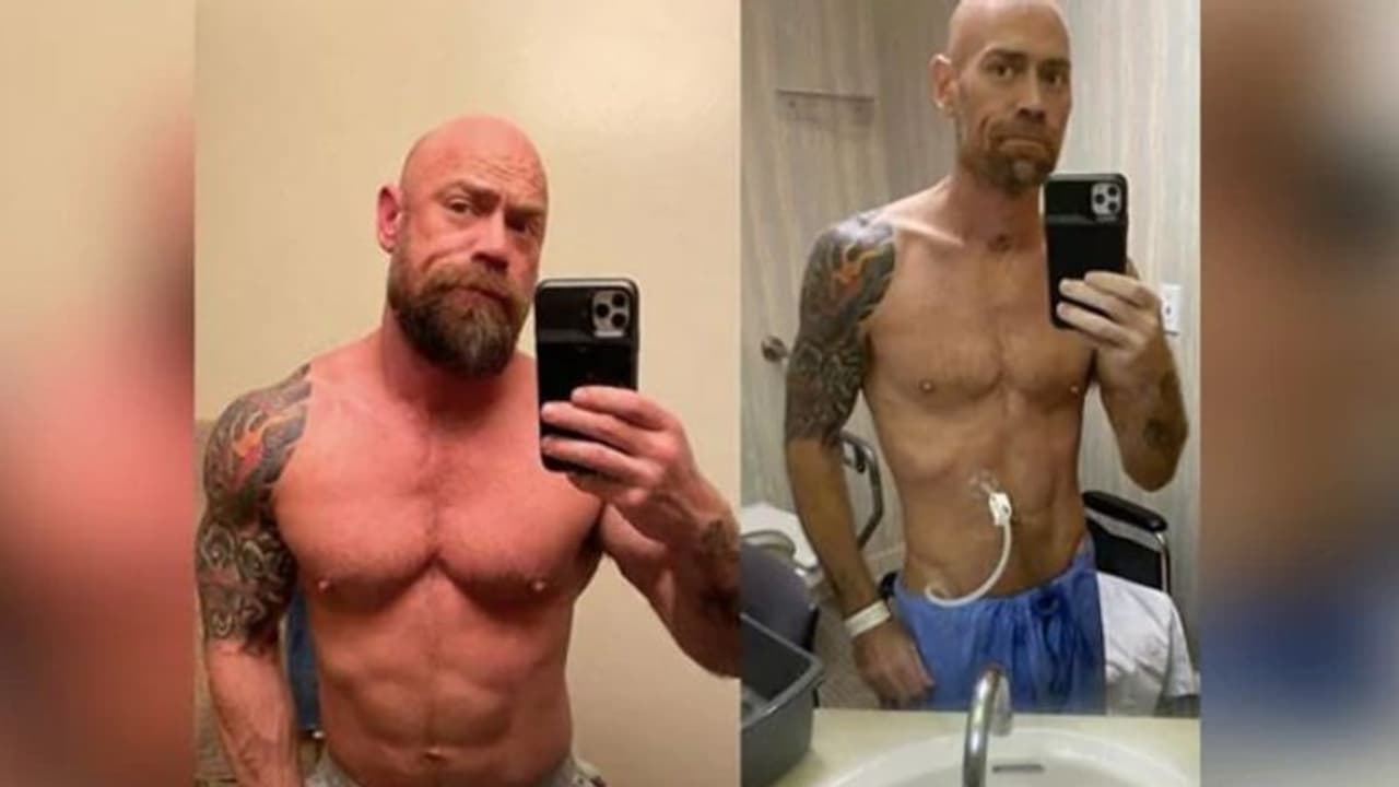 'കൊറോണ വരുത്തിയ മാറ്റം'; ഞെട്ടിക്കുന്ന ഫോട്ടോകള് പങ്കുവച്ച് രോഗത്തില് നിന്ന് രക്ഷപ്പെട്ടയാള്... 'കൊറോണ വരുത്തിയ മാറ്റം'; ഞെട്ടിക്കുന്ന ഫോട്ടോകള് പങ്കുവച്ച് രോഗത്തില് നിന്ന് രക്ഷപ്പെട്ടയാള്...