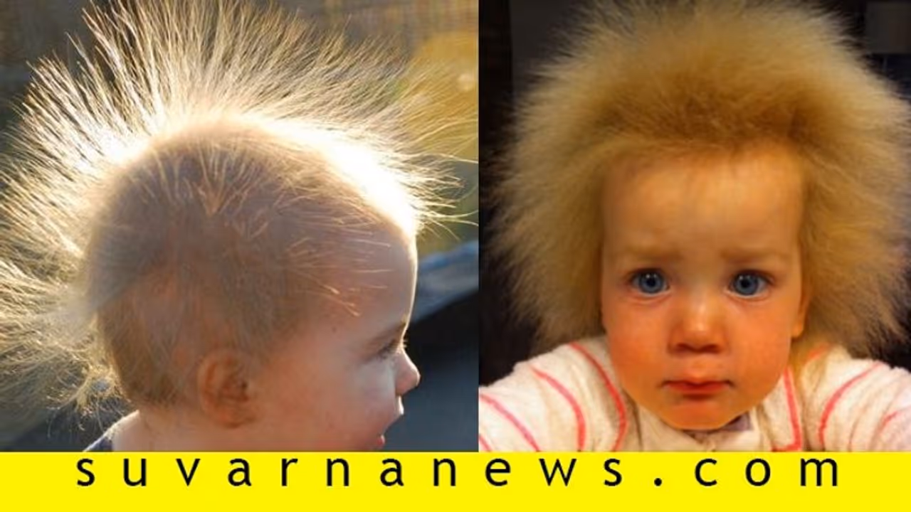 ಈ ಸಮಸ್ಯೆ ಇರುವವರು ಜಗತ್ತಿನಲ್ಲಿ ಹತ್ತಿರತ್ತಿರ ನೂರು ಮಂದಿ ಮಾತ್ರ!