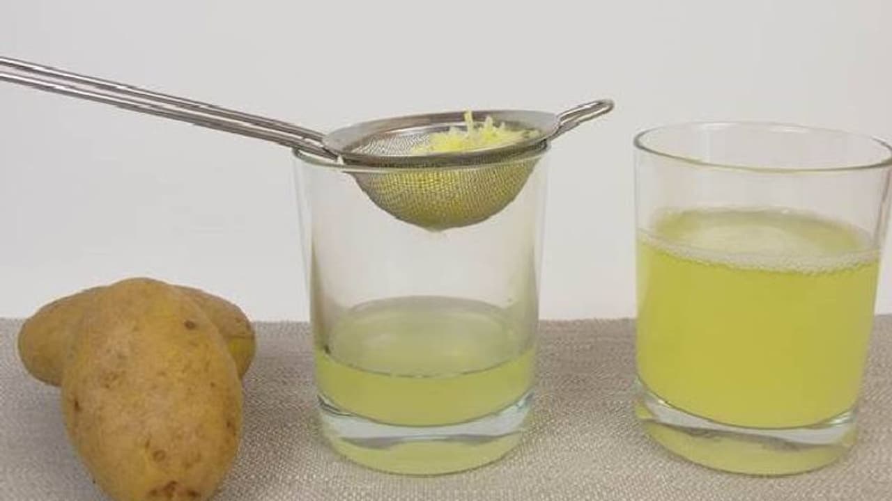 മുഖത്തെ പാടുകള് മാറ്റും; ഉരുളക്കിഴങ്ങ് കൊണ്ട് ചര്മ്മം സംരക്ഷിക്കാനുളള ചില വഴികള്... മുഖത്തെ പാടുകള് മാറ്റും; ഉരുളക്കിഴങ്ങ് കൊണ്ട് ചര്മ്മം സംരക്ഷിക്കാനുളള ചില വഴികള്...