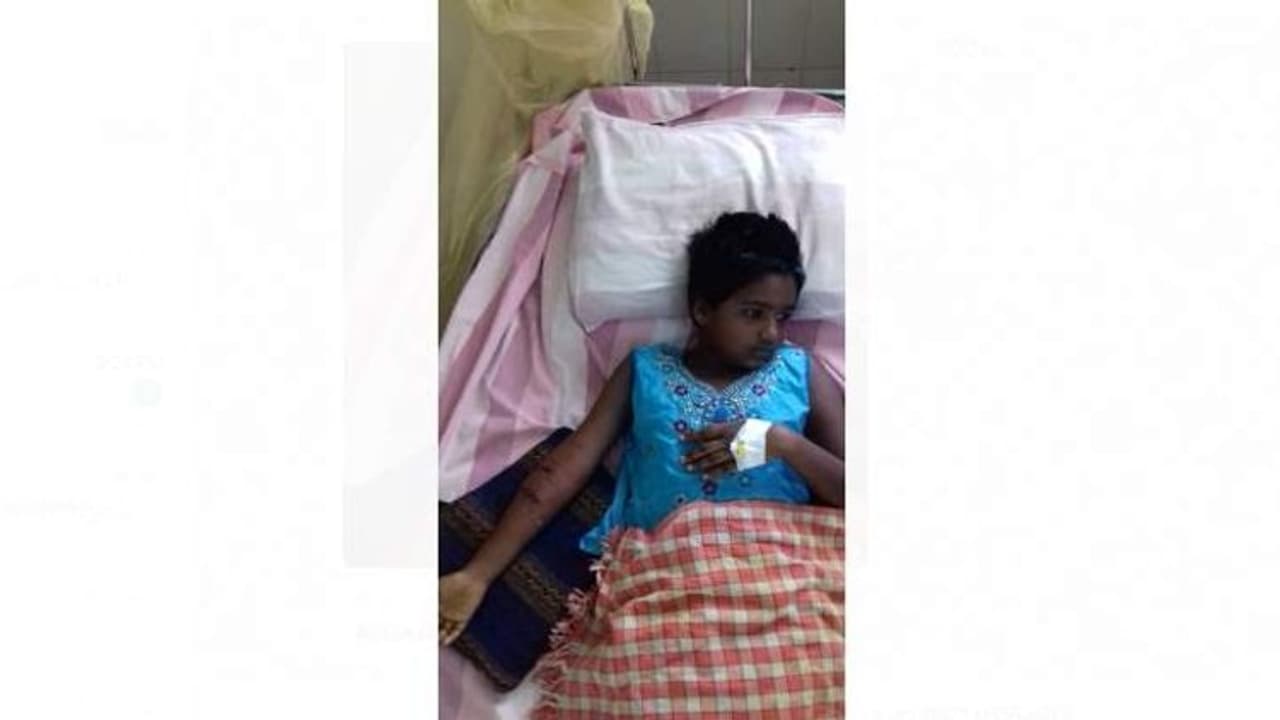 சிவகங்கை அருகே சிறுமியை கடித்து குதறிய குரங்கு.!! அலட்சியம் காட்டும் வனத்துறை என பொதுமக்கள் புகார்.!! சிவகங்கை அருகே சிறுமியை கடித்து குதறிய குரங்கு.!! அலட்சியம் காட்டும் வனத்துறை என பொதுமக்கள் புகார்.!!