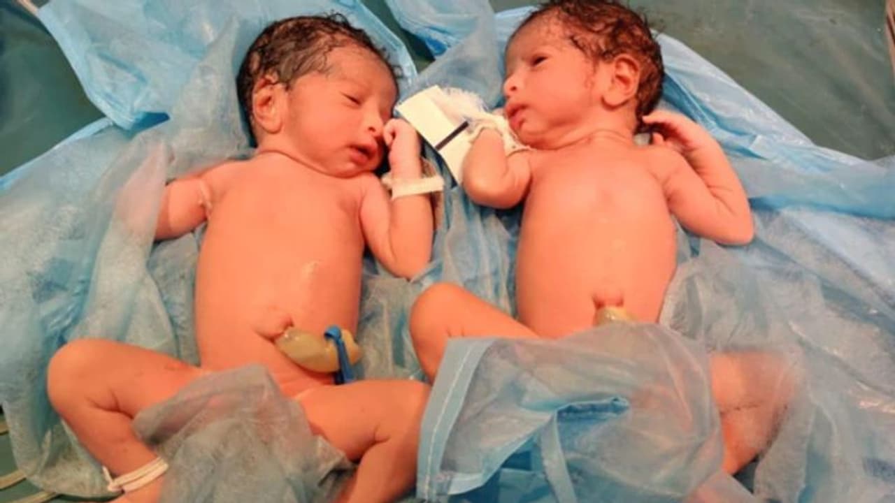 കൊവിഡിനോട് പൊരുതുന്ന യുവതി ഇരട്ടക്കുട്ടികൾക്ക് ജന്മം നൽകി കൊവിഡിനോട് പൊരുതുന്ന യുവതി ഇരട്ടക്കുട്ടികൾക്ക് ജന്മം നൽകി