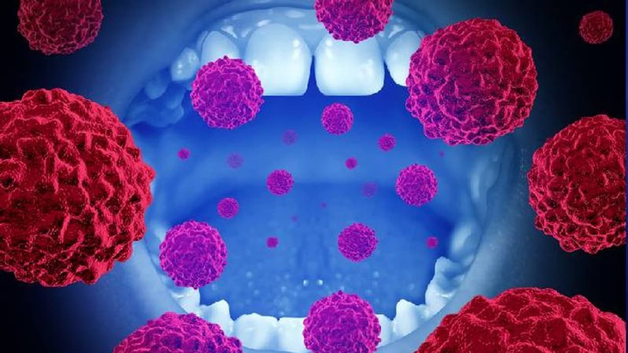 ഓറല്‍ ക്യാന്‍സര്‍; തുടക്കത്തിലെ കാണിക്കുന്ന ഈ ലക്ഷണങ്ങളെ അവഗണിക്കരുത് !
