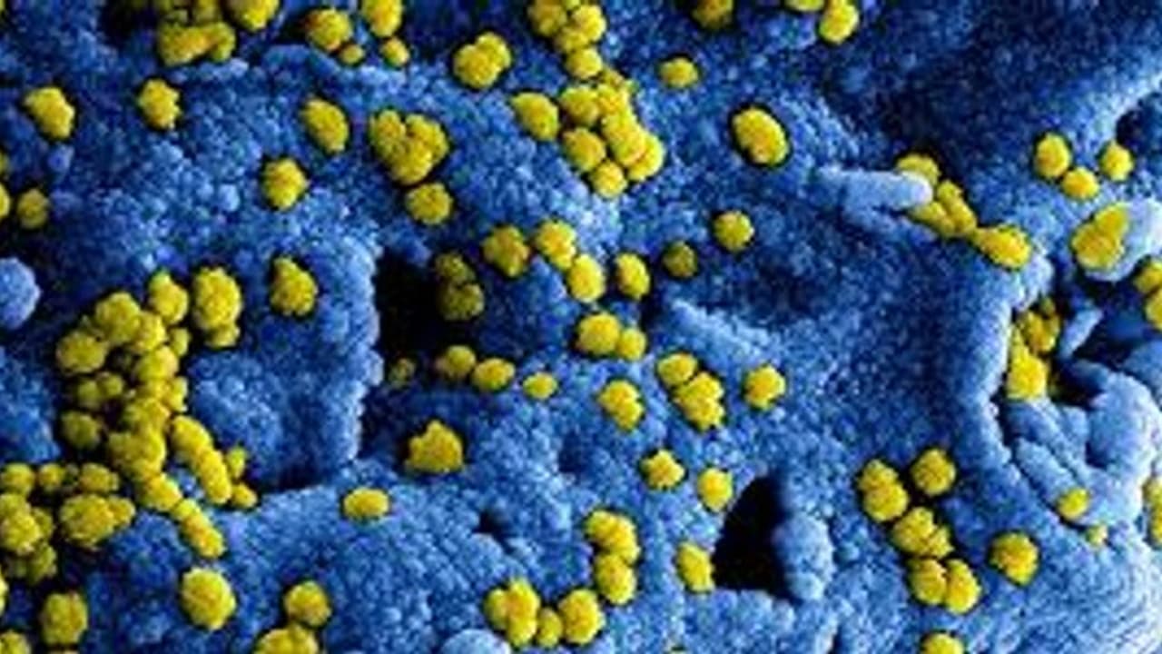 ಉಡುಪಿ: ಮತ್ತೆ 62 ಮಂದಿಗೆ ‘ಮಹಾ’ ಸೋಂಕು