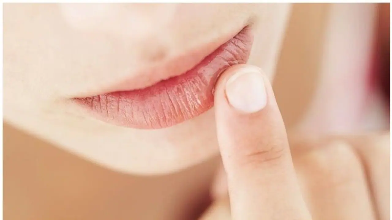 Health Tips : വെയിലേറ്റ് ചുണ്ട് ഡ്രൈ ആകാതിരിക്കാനും പൊള്ളലേല്‍ക്കാതിരിക്കാനും ചെയ്യേണ്ടത്...