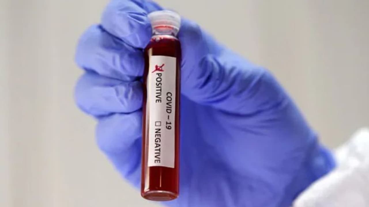 ലോകത്ത് അറുപത്തിയഞ്ചര ലക്ഷം കൊവിഡ് രോഗികള്‍; അമേരിക്കയില്‍ സ്ഥിതി ഗുരുതരമായി തുടരുന്നു