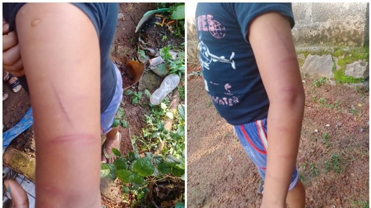 മൂന്നാം ക്ലാസുകാരന് ട്യൂഷന് ക്ലാസില് മര്ദ്ദനം; വാര്ഡ് മെമ്പറുടെ പരാതിയില് അധ്യാപകനെതിരേ കേസ് മൂന്നാം ക്ലാസുകാരന് ട്യൂഷന് ക്ലാസില് മര്ദ്ദനം; വാര്ഡ് മെമ്പറുടെ പരാതിയില് അധ്യാപകനെതിരേ കേസ്