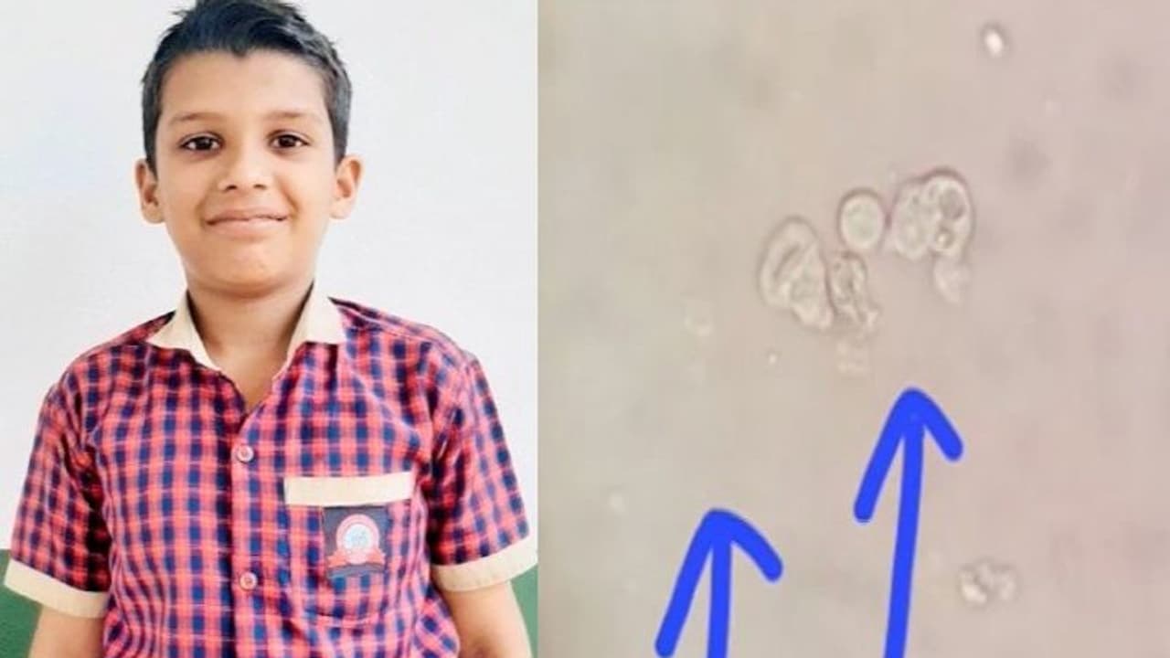 നീന്തല്‍ക്കുളത്തില്‍ അധികനേരം ചിലവിട്ടു; തലച്ചോറില്‍ 'അമീബ' കയറി കോട്ടയ്ക്കലിൽ പന്ത്രണ്ടുകാരന്‍ മരിച്ചു