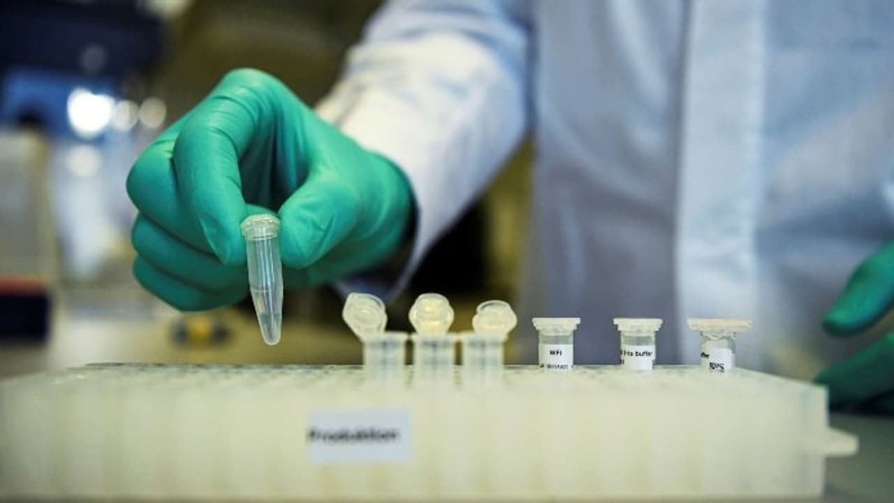 കൊവിഡ് വാക്സിൻ വികസിപ്പിക്കുന്ന കമ്പനിയുടെ ഓഹരി ജർമ്മൻ സർക്കാർ വാങ്ങുന്നു കൊവിഡ് വാക്സിൻ വികസിപ്പിക്കുന്ന കമ്പനിയുടെ ഓഹരി ജർമ്മൻ സർക്കാർ വാങ്ങുന്നു