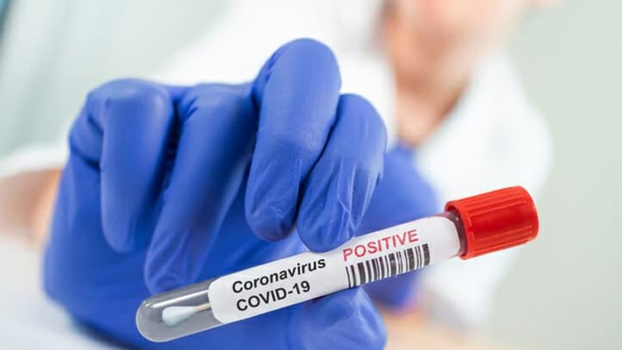 ಬಡವರಿಗೆ 50ಕ್ಕೂ ಹೆಚ್ಚು ಖಾಸಗಿ ಆಸ್ಪತ್ರೆಗಳಲ್ಲಿ ಕೊರೋನಾ ಉಚಿತ ಚಿಕಿತ್ಸೆ! ಬಡವರಿಗೆ 50ಕ್ಕೂ ಹೆಚ್ಚು ಖಾಸಗಿ ಆಸ್ಪತ್ರೆಗಳಲ್ಲಿ ಕೊರೋನಾ ಉಚಿತ ಚಿಕಿತ್ಸೆ!