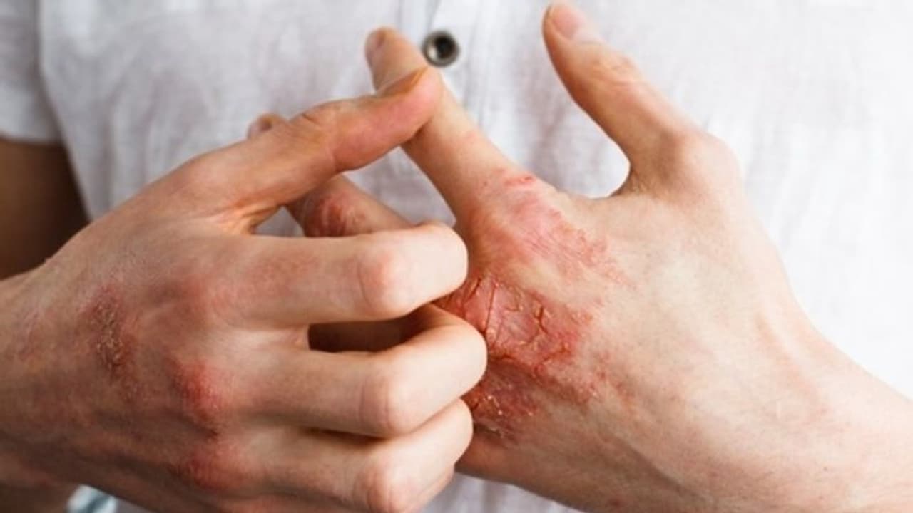 തൊലിപ്പുറത്ത് കാണുന്ന ചൊറിയുള്‍പ്പെടെയുള്ള പ്രശ്‌നങ്ങള്‍; കാരണം ഇതാകാം...