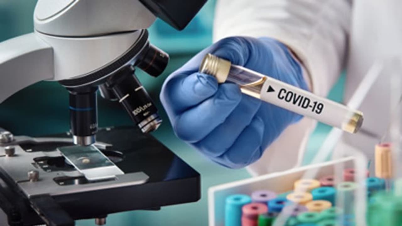 ಮಾಹಿತಿ ಮುಚ್ಚಿಟ್ಟು ಸೋಂಕು ಹರಡಿದ ಸಹೋದರರು..!