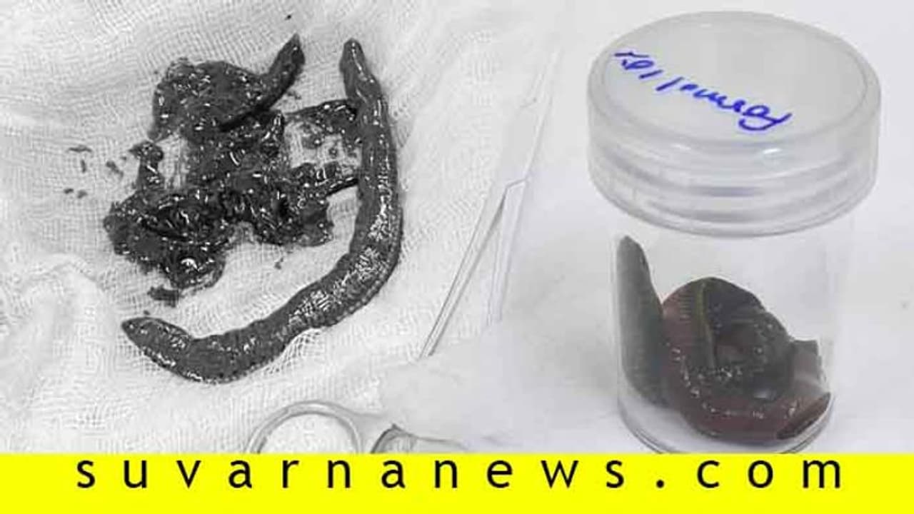 ಸ್ವಿಮ್ಮಿಂಗ್ ಮಾಡ್ತಿದ್ದ ವೃದ್ಧನ ಶಿಶ್ನದೊಳಗೆ ನುಗ್ಗಿದ ಲೀಚ್..! ರಕ್ತ ಹೀರಿದ್ರೂ ಗೊತ್ತೇ ಆಗಿಲ್ಲ