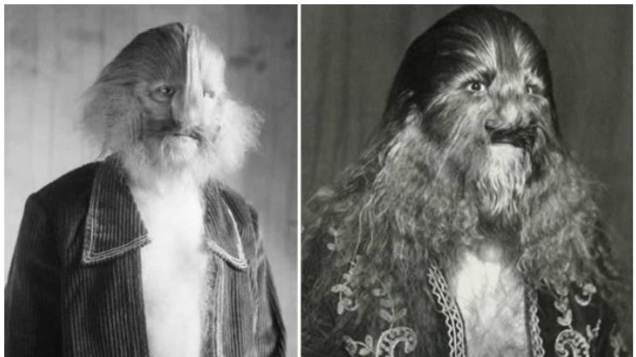 ശരീരം മുഴുവൻ മുടി, രൂപം കണ്ട് സ്വന്തം അമ്മ പോലും ഉപേക്ഷിച്ചു, ഒടുവില് സര്ക്കസ് കമ്പനിയില് ജീവിതം... ശരീരം മുഴുവൻ മുടി, രൂപം കണ്ട് സ്വന്തം അമ്മ പോലും ഉപേക്ഷിച്ചു, ഒടുവില് സര്ക്കസ് കമ്പനിയില് ജീവിതം...