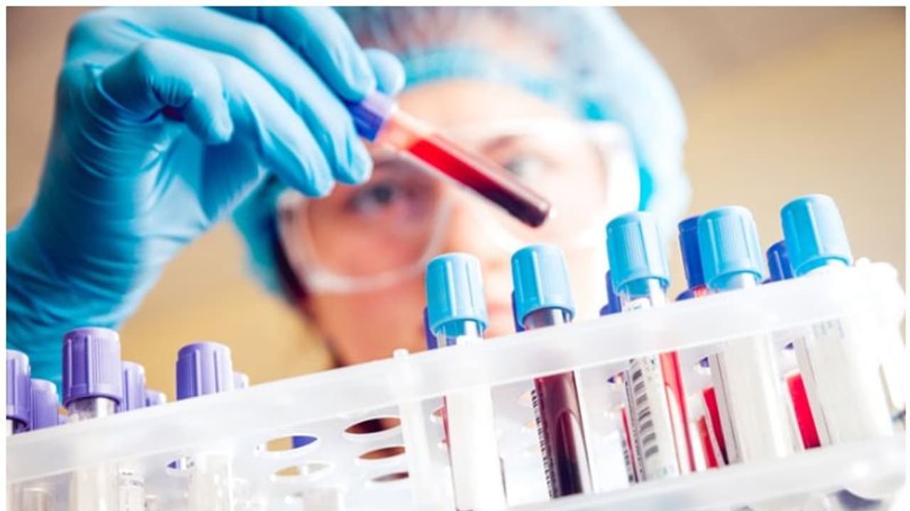 ಉಡುಪಿಯ 600 ಬಸ್ಸು ಚಾಲಕರಿಗೆ ಕೋವಿಡ್ ಪರೀಕ್ಷೆ ಉಡುಪಿಯ 600 ಬಸ್ಸು ಚಾಲಕರಿಗೆ ಕೋವಿಡ್ ಪರೀಕ್ಷೆ