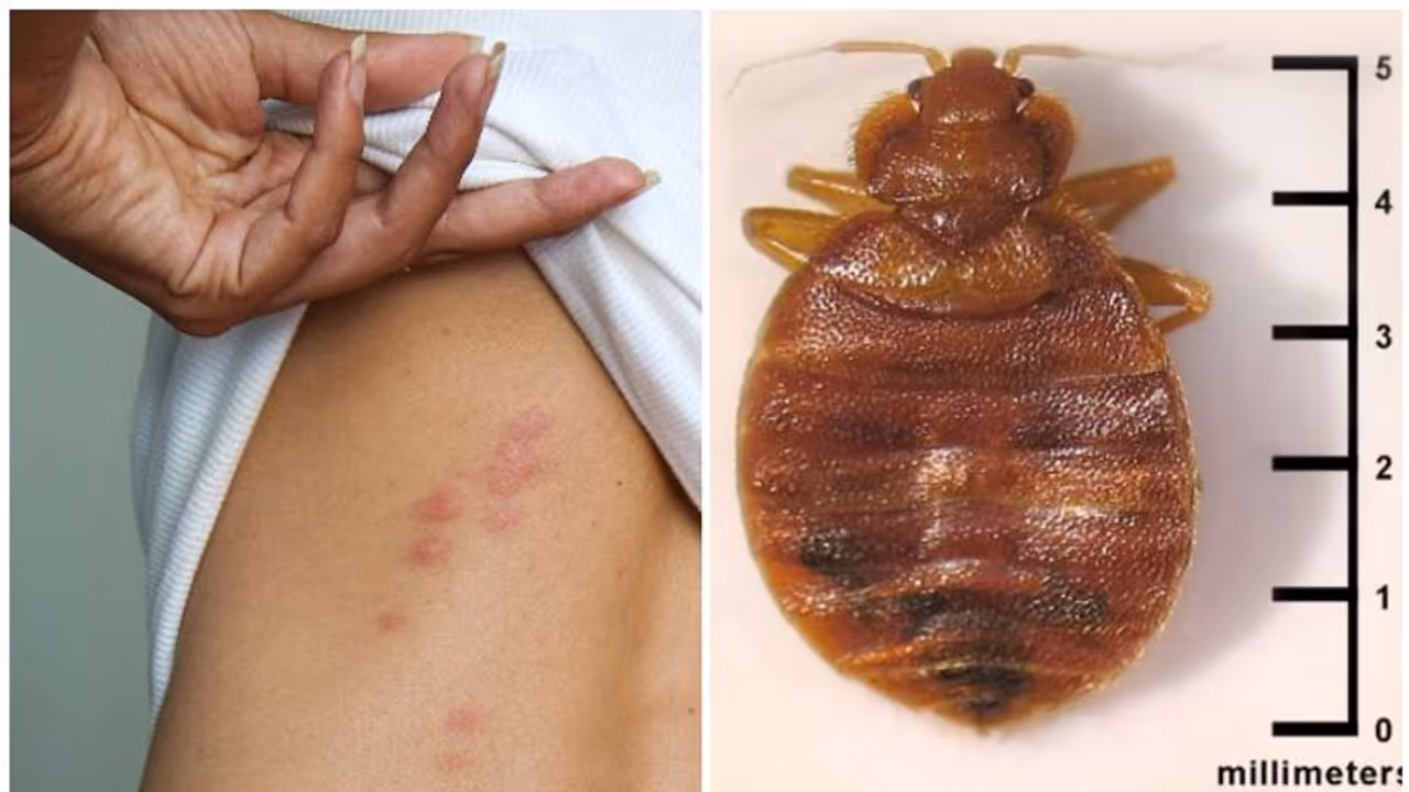 മൂട്ടശല്യം എങ്ങനെ കണ്ടെത്താം? എങ്ങനെ ഒഴിപ്പിക്കാം? അറിയേണ്ടതെല്ലാം മൂട്ടശല്യം എങ്ങനെ കണ്ടെത്താം? എങ്ങനെ ഒഴിപ്പിക്കാം? അറിയേണ്ടതെല്ലാം