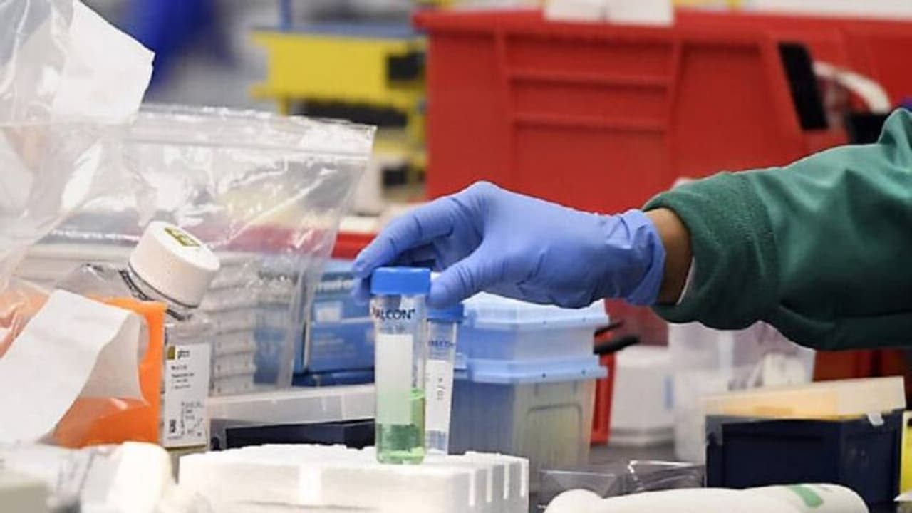 27 പുതിയ രോഗികള്, 22 ഉം സമ്പര്ക്കത്തിലൂടെ, 14 പേര്ക്ക് യാത്രാപശ്ചാത്തലം പോലുമില്ല; തലസ്ഥാനത്ത് അതീവ ജാഗ്രത 27 പുതിയ രോഗികള്, 22 ഉം സമ്പര്ക്കത്തിലൂടെ, 14 പേര്ക്ക് യാത്രാപശ്ചാത്തലം പോലുമില്ല; തലസ്ഥാനത്ത് അതീവ ജാഗ്രത