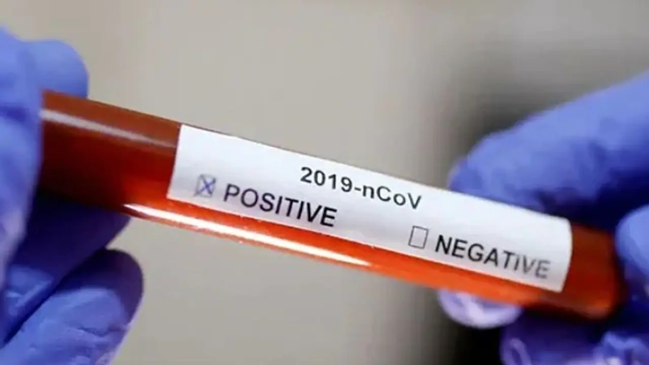 హైదరాబాద్లో కార్పోరేట్ ఆసుపత్రుల దందా.. కరోనా రోగులతో వ్యాపారం హైదరాబాద్లో కార్పోరేట్ ఆసుపత్రుల దందా.. కరోనా రోగులతో వ్యాపారం