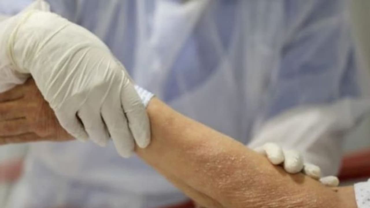 രണ്ട് മഹാമാരികളെ പോരാടിത്തോല്പ്പിച്ച 106കാരന്; പ്രത്യാശയുടെ പ്രതീകം രണ്ട് മഹാമാരികളെ പോരാടിത്തോല്പ്പിച്ച 106കാരന്; പ്രത്യാശയുടെ പ്രതീകം