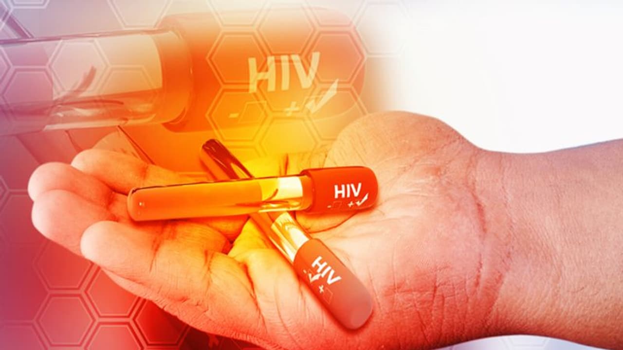 HIV Infection | ചികിത്സയില്ലാതെ തന്നെ എച്ച്ഐവിവൈറസിന്റെ പിന്മാറ്റം; കണ്ടെത്തലുമായി ഗവേഷകര് HIV Infection | ചികിത്സയില്ലാതെ തന്നെ എച്ച്ഐവിവൈറസിന്റെ പിന്മാറ്റം; കണ്ടെത്തലുമായി ഗവേഷകര്