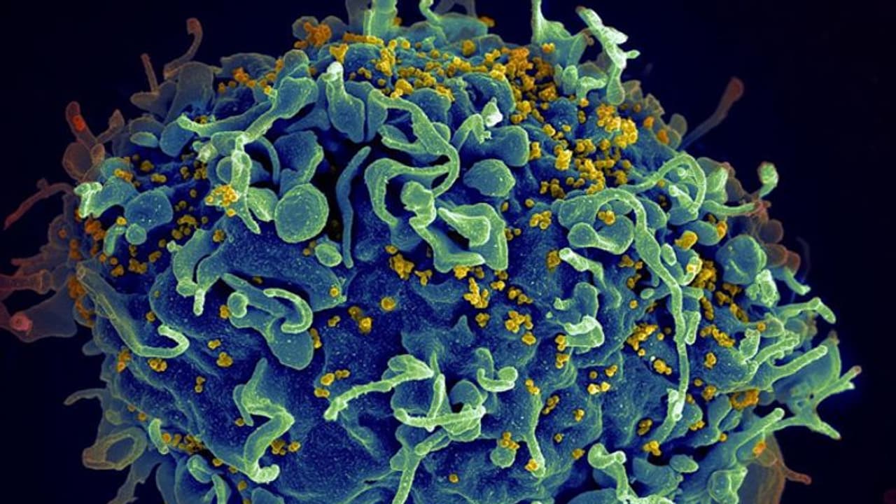 HIV+ মহিলার শরীরে ৩২ বার করোনার রূপ বদল, Covid 19 এ আক্রান্তের ২১৬ দিনের লড়াইয়ে চিন্তা গবেষকদের HIV+ মহিলার শরীরে ৩২ বার করোনার রূপ বদল, Covid 19 এ আক্রান্তের ২১৬ দিনের লড়াইয়ে চিন্তা গবেষকদের