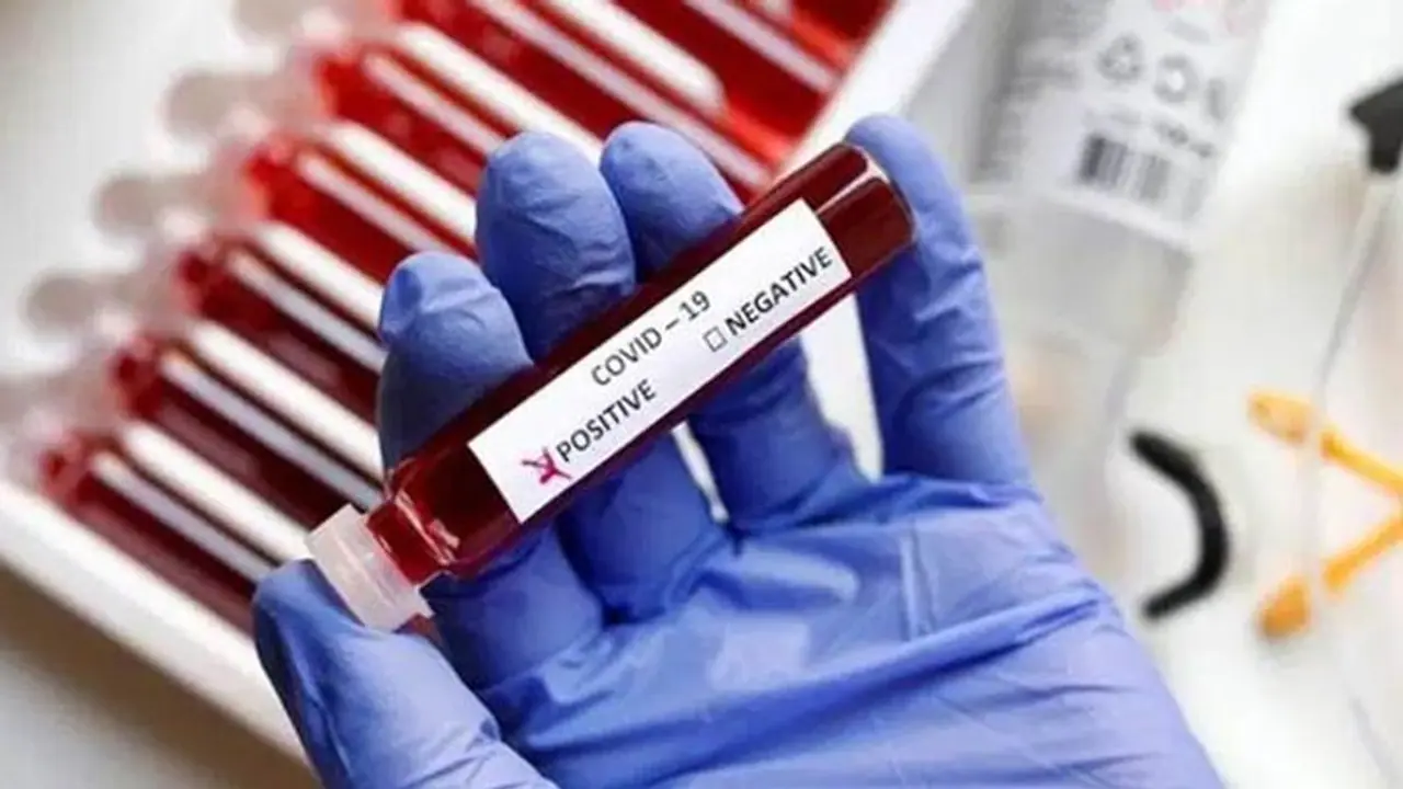 രോഗിക്ക് കൊവിഡ്; എറണാകുളം ജനറല് ആശുപത്രിയില് പ്രതിസന്ധി രോഗിക്ക് കൊവിഡ്; എറണാകുളം ജനറല് ആശുപത്രിയില് പ്രതിസന്ധി