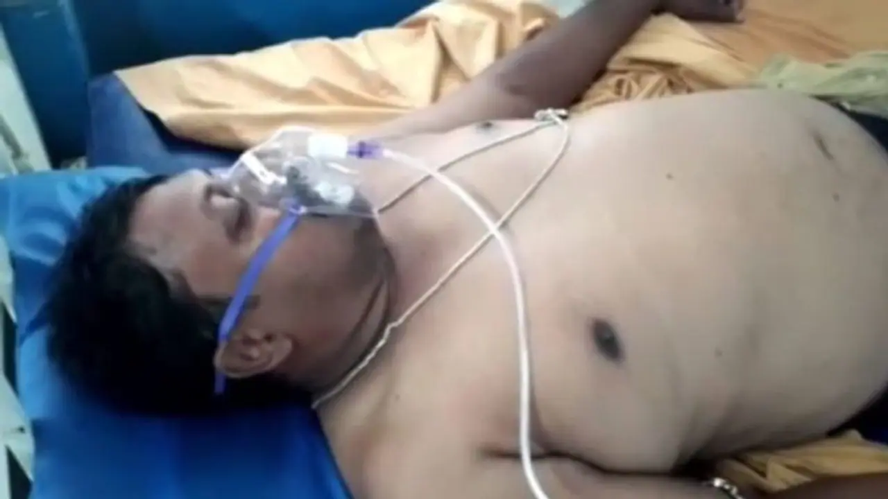 রাস্তায় ফেলে বেধড়ক মার, হাওড়ায় আক্রান্ত তৃণমূলের পঞ্চায়েত প্রধান