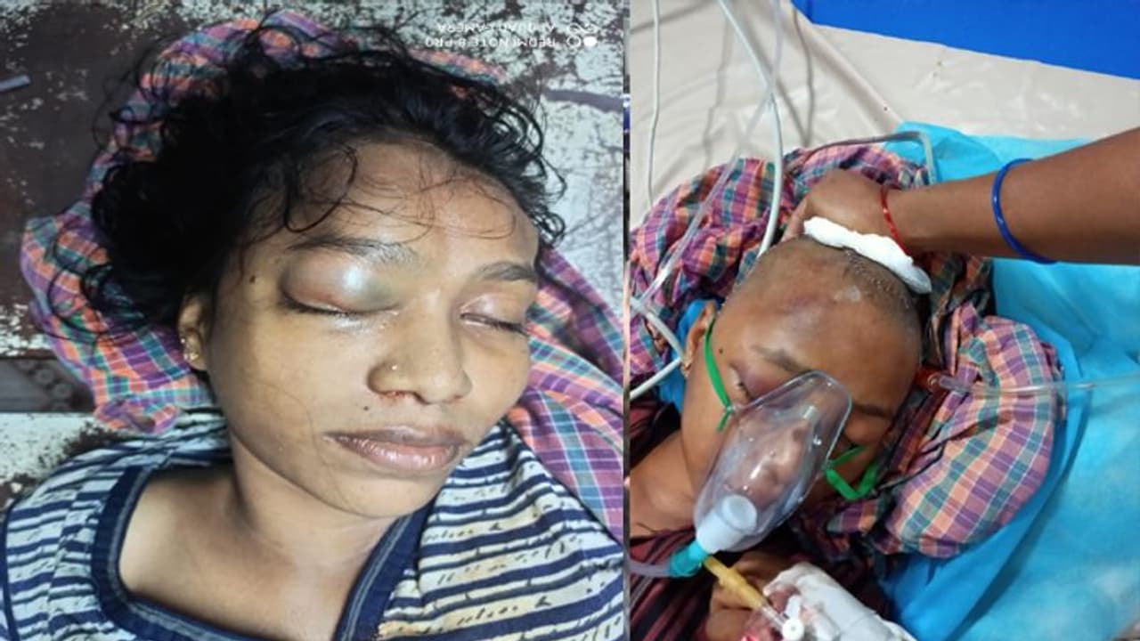 మాస్కు ధరించనందుకు కుటుంబంపై కర్రలతో దాడి... యువతి మృతి మాస్కు ధరించనందుకు కుటుంబంపై కర్రలతో దాడి... యువతి మృతి