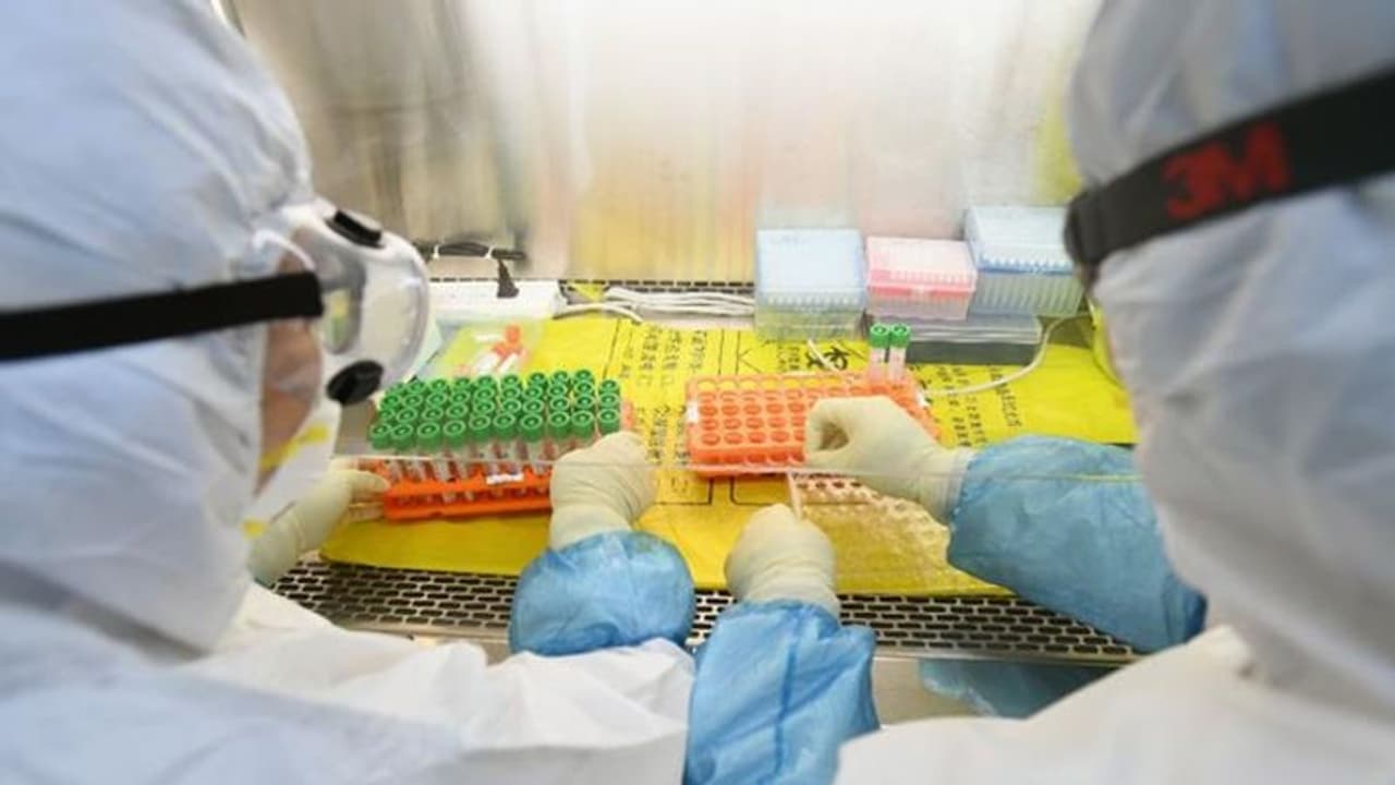 കൊവിഡ് വൈറസ് ആദ്യമായി വന്നത് എവിടെ നിന്ന്? ഏറ്റവും നിര്ണായകമായ വിവരം പങ്കുവച്ച് എഫ്ബിഐ കൊവിഡ് വൈറസ് ആദ്യമായി വന്നത് എവിടെ നിന്ന്? ഏറ്റവും നിര്ണായകമായ വിവരം പങ്കുവച്ച് എഫ്ബിഐ