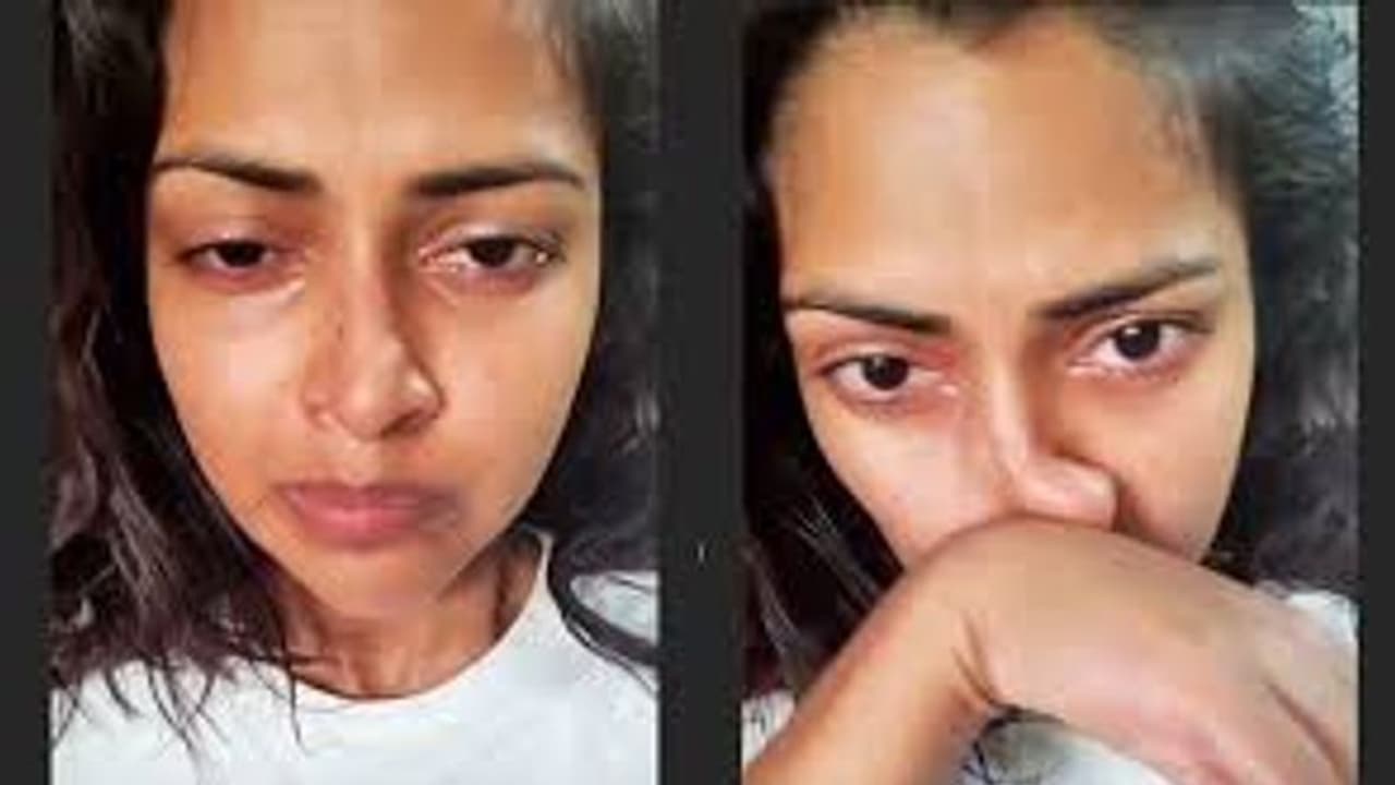 கண்ணீர் விட்ட அமலா பால்... “இதற்கு வேறு வழியில்லையா” என கதறல்... காரணம் இது தான்...!! கண்ணீர் விட்ட அமலா பால்... “இதற்கு வேறு வழியில்லையா” என கதறல்... காரணம் இது தான்...!!