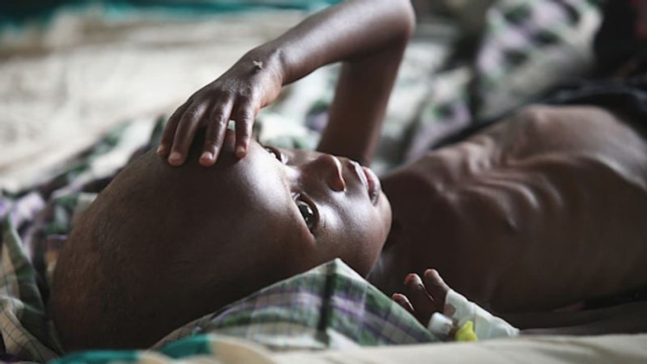 COVID 19 pandemic: 130 million more people may face chronic hunger by end of 2020 COVID 19 pandemic: 130 million more people may face chronic hunger by end of 2020