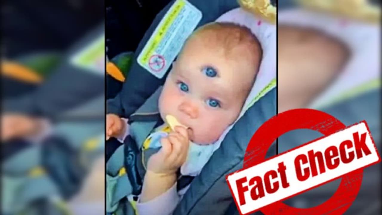 ভাইরাল তিন চোখের 'অলৌকিক শিশু'র ভিডিও, জেনেটিক রোগ না ফলে গেল ব্রহ্মগুরুর ভবিষ্যদ্বাণী