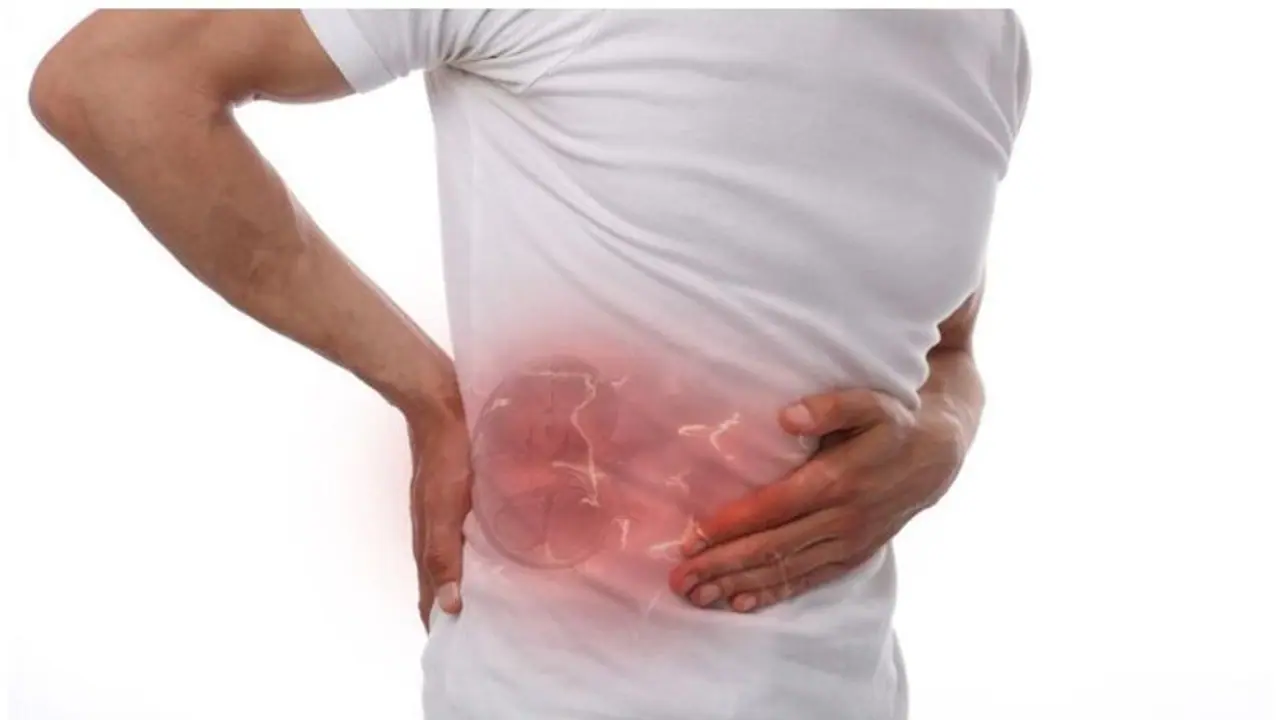 Kidney Stone : മൂത്രത്തില്‍ കല്ലിന് സാധ്യത കൂടുതലും ആര്‍ക്ക്? ലക്ഷണങ്ങളും അറിയാം...