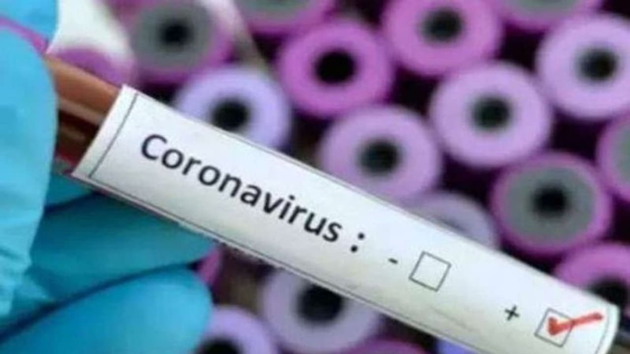 কলকাতা যোগে করোনা সংক্রমণ, রামপুরহাটে আরও এক প্রৌঢ়ের মৃত্যু কলকাতা যোগে করোনা সংক্রমণ, রামপুরহাটে আরও এক প্রৌঢ়ের মৃত্যু