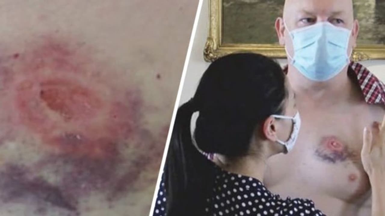 మాస్క్ పెట్టుకోమన్నందుకు.. బస్సులో అందరి ముందు ఛాతిపై కొరికి జంప్ మాస్క్ పెట్టుకోమన్నందుకు.. బస్సులో అందరి ముందు ఛాతిపై కొరికి జంప్