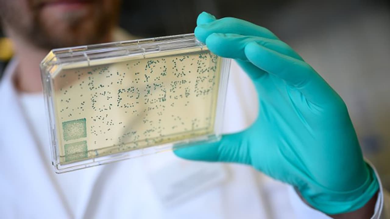 a man is looking at a carrier with bacteria from which DNA and subsequently RNA is obtained a man is looking at a carrier with bacteria from which DNA and subsequently RNA is obtained