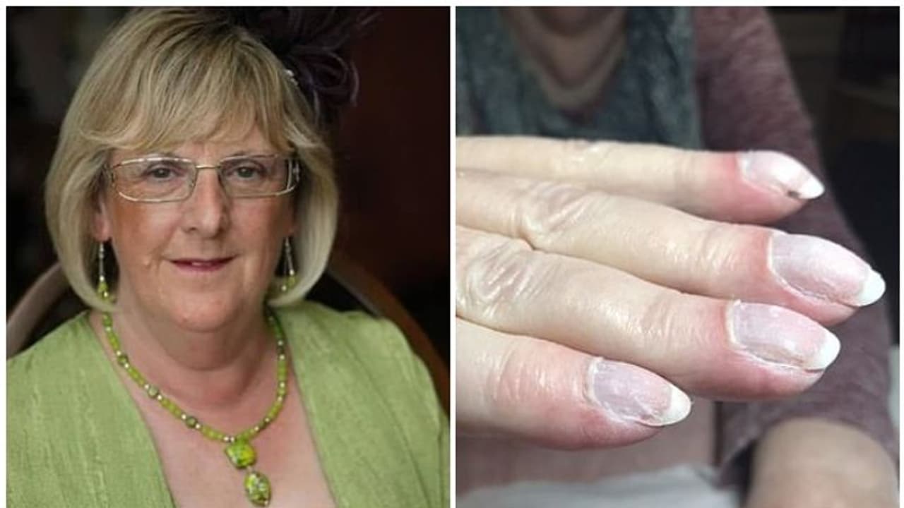 വയോധികയുടെ ജീവൻ രക്ഷിച്ചത് ബ്യൂട്ടീഷന്റെ കരുതൽ, മാനിക്യൂറിനിടെ തോന്നിയ സംശയം വെളിപ്പെടുത്തിയത് ശ്വാസകോശാർബുദം വയോധികയുടെ ജീവൻ രക്ഷിച്ചത് ബ്യൂട്ടീഷന്റെ കരുതൽ, മാനിക്യൂറിനിടെ തോന്നിയ സംശയം വെളിപ്പെടുത്തിയത് ശ്വാസകോശാർബുദം