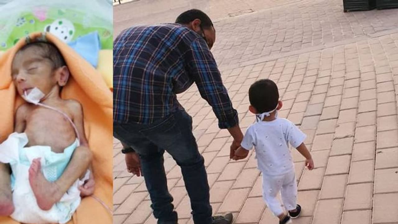 'ഡോക്ടര്‍മാര്‍ ജീവനോടെ കിട്ടില്ല എന്നു പറഞ്ഞ കുഞ്ഞാണിത്'; കണ്ണ് നനയ്ക്കും കുറിപ്പുമായി ഒരമ്മ