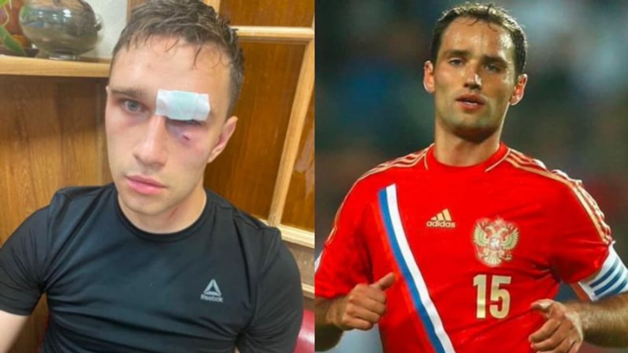 মাঠেই রেফারিকে লাথি ঘুষি রাশিয়ার প্রাক্তন অধিনায়কের, গুরুতর আহত রেফারি, দেখুন ভাইরাল ভিডিও মাঠেই রেফারিকে লাথি ঘুষি রাশিয়ার প্রাক্তন অধিনায়কের, গুরুতর আহত রেফারি, দেখুন ভাইরাল ভিডিও