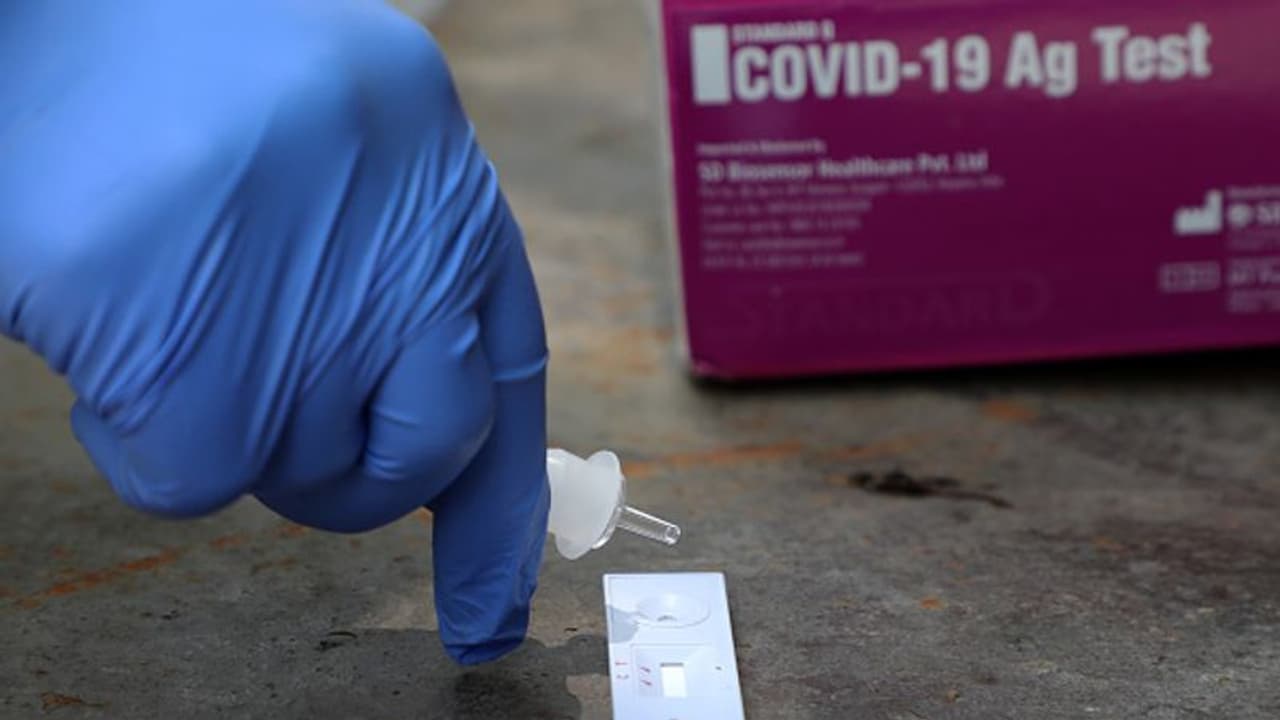 കൊവിഡ് ഭേദമായ ശേഷം എട്ടിലൊരാള് മരിക്കുന്നതായി യുകെ പഠനം കൊവിഡ് ഭേദമായ ശേഷം എട്ടിലൊരാള് മരിക്കുന്നതായി യുകെ പഠനം