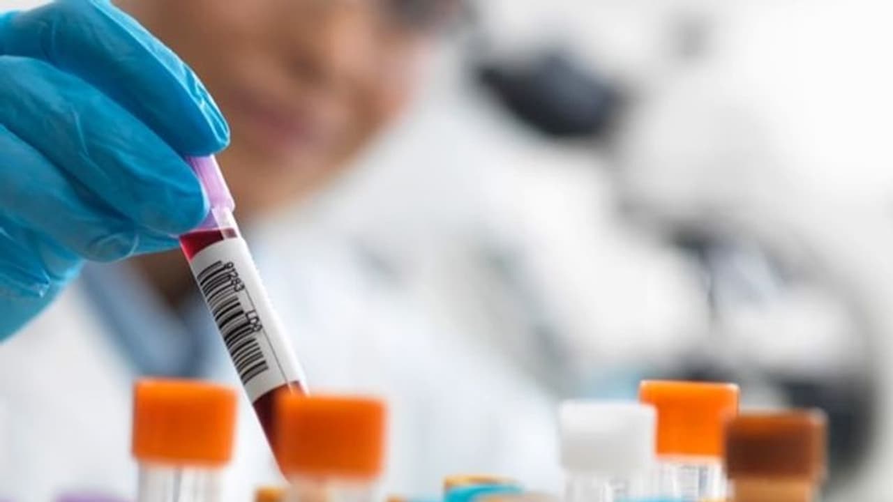 4 people labelled COVID 19 positive without test; West Bengal health department sees panic among residents 4 people labelled COVID 19 positive without test; West Bengal health department sees panic among residents