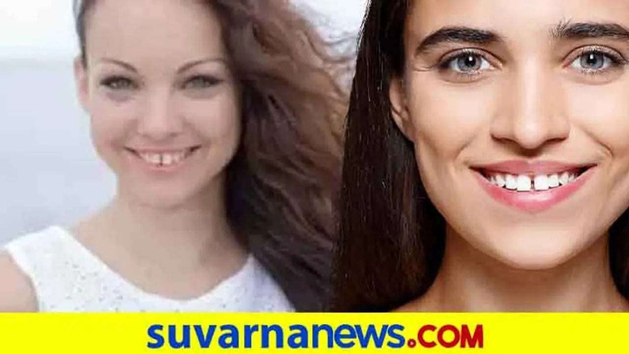 ಹಲ್ಲಿನ ಮಧ್ಯೆ ಅಕ್ಕಿಕಾಳಿನಷ್ಟು ಜಾಗ ಬಿಟ್ಟಿದ್ದರೆ ಏನು ಅರ್ಥ ಅಂತ ಗೊತ್ತಾ..!?