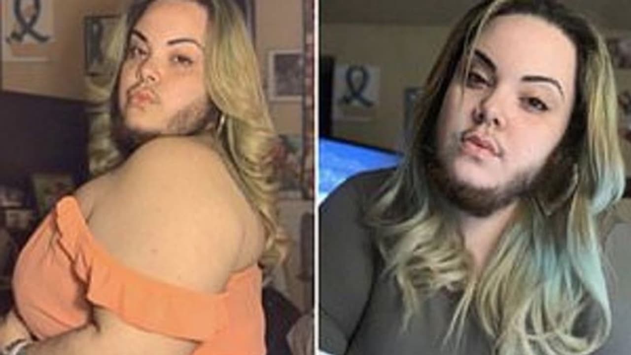 എട്ട് വര്ഷം ഷേവ് ചെയ്തൊളിപ്പിച്ചു; ഇപ്പോള് ആല്മയ്ക്ക് താടി അഴകാണ്... എട്ട് വര്ഷം ഷേവ് ചെയ്തൊളിപ്പിച്ചു; ഇപ്പോള് ആല്മയ്ക്ക് താടി അഴകാണ്...