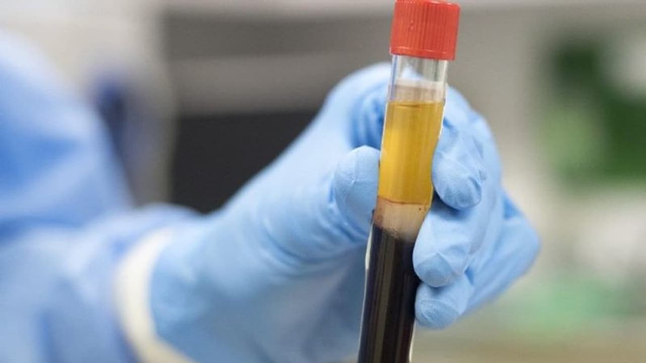 കൊവിഡിനെതിരെ പ്ലാസ്മ തെറാപ്പി; ആശങ്ക പ്രകടിപ്പിച്ച് ലോകാരോഗ്യ സംഘടന കൊവിഡിനെതിരെ പ്ലാസ്മ തെറാപ്പി; ആശങ്ക പ്രകടിപ്പിച്ച് ലോകാരോഗ്യ സംഘടന