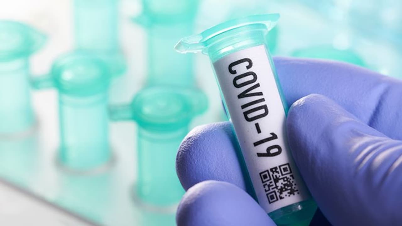 রাজ্য়ে দেড় লক্ষ ছাড়াল করোনা আক্রান্তের সংখ্যা, ২৪ ঘণ্টায় মৃত্যু হয়েছে ৫৩ জনের
