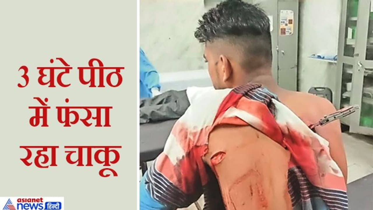 पीठ में धंसा चाकू लेकर 15 किमी दूर अस्पताल पहुंचा घायल, डॉक्टर बोले 'हमसे नहीं निकलेगा' पीठ में धंसा चाकू लेकर 15 किमी दूर अस्पताल पहुंचा घायल, डॉक्टर बोले 'हमसे नहीं निकलेगा'